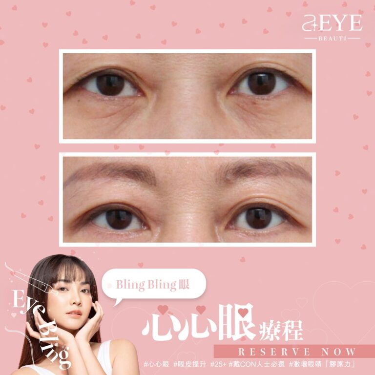 Aeye_EYE BLING_心心眼_眼皮提升_01