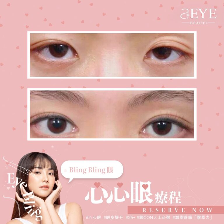 Aeye_EYE BLING_心心眼_眼皮提升_02