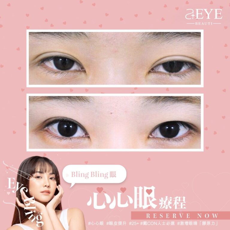 Aeye_EYE BLING_心心眼_眼皮提升_03