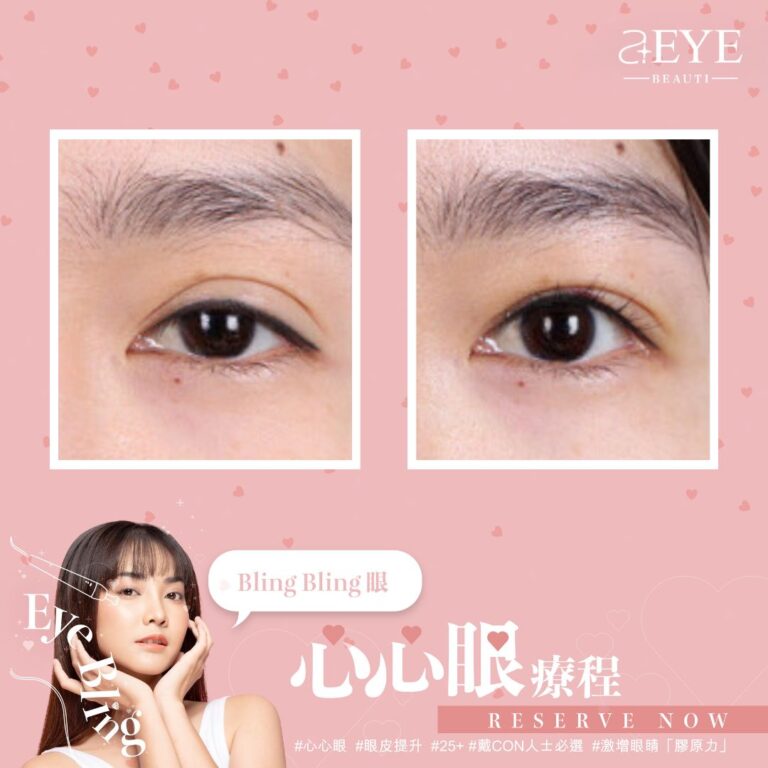 Aeye_EYE BLING_心心眼_眼皮提升_04