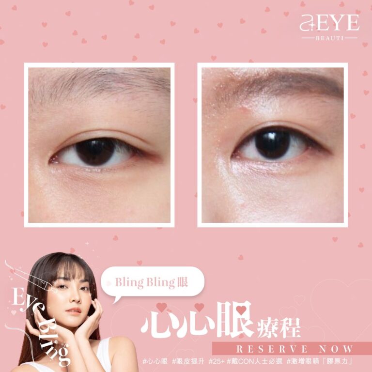 Aeye_EYE BLING_心心眼_眼皮提升_05