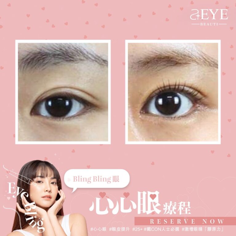 Aeye_EYE BLING_心心眼_眼皮提升_06