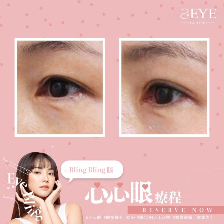 Aeye_EYE BLING_心心眼_眼皮提升_07